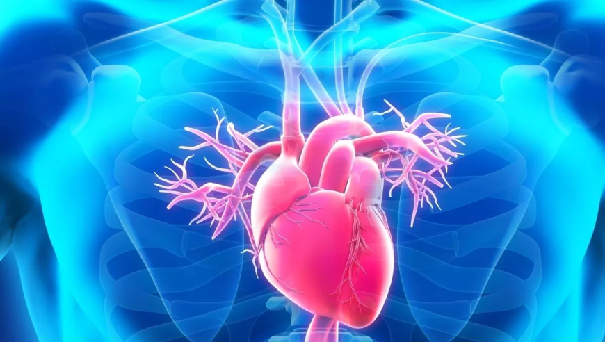 Aneurisma da Aorta